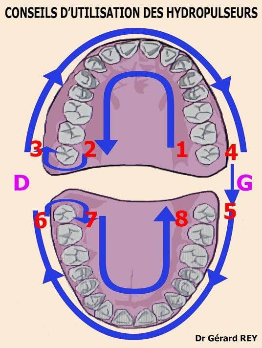 TRIOBOX - Quale scegliere? Oral-B, Waterpik o Broxo? - immagine 9